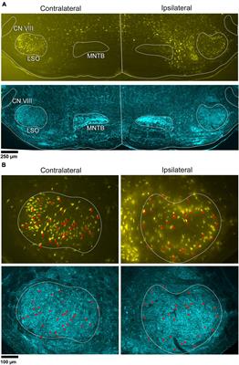 Bilateral and symmetric glycinergic and glutamatergic projections from the LSO to the IC in the CBA/CaH mouse